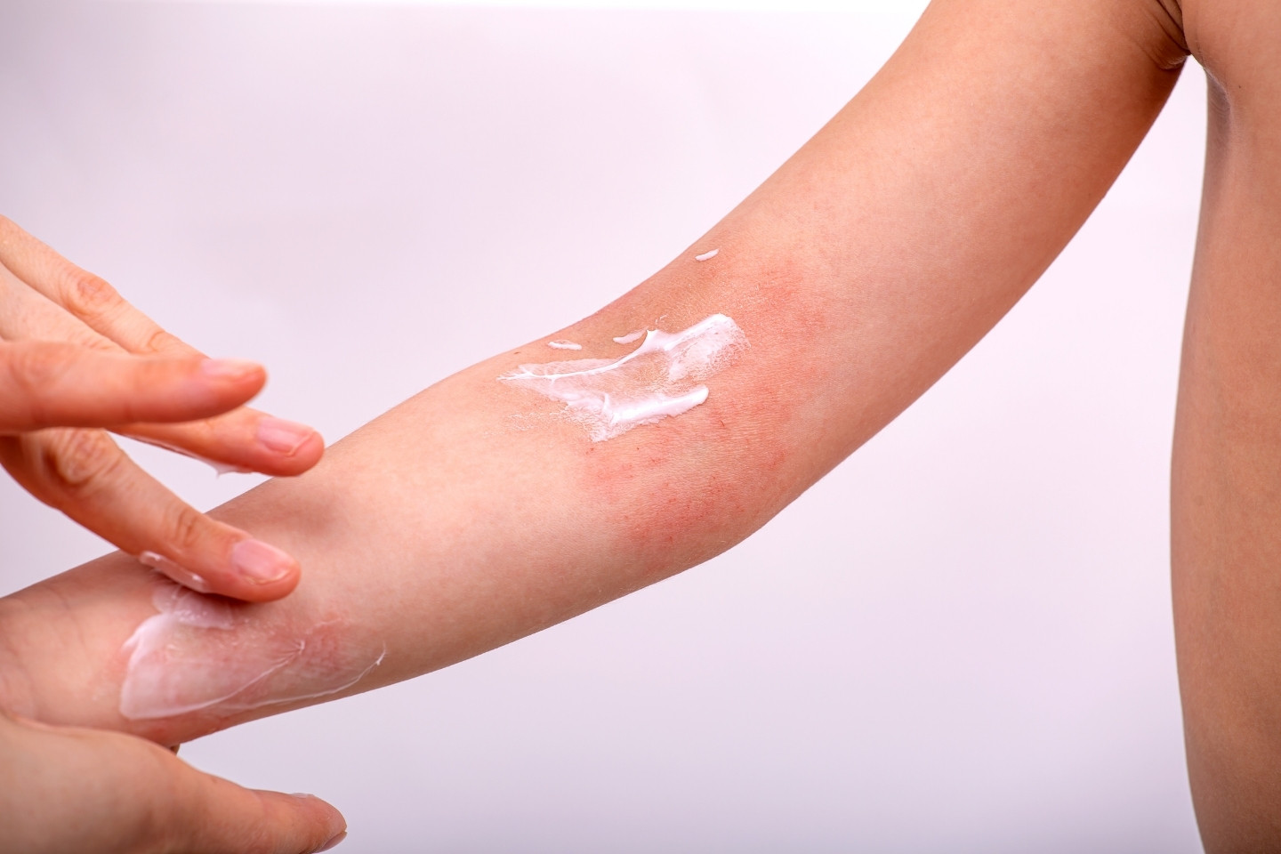 Ako prať pri atopickom ekzéme-3